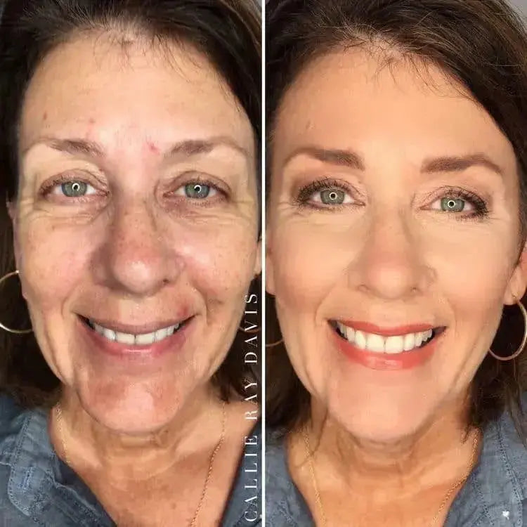 Ageless Skin Kit (+2 Free Gifts)